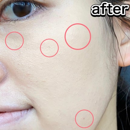 スーン クッションコンシーラー /エリザベス/クッションファンデーションを使ったクチコミ(7枚目)