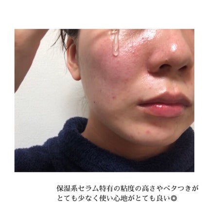 ダイブイン セラム/Torriden/美容液を使ったクチコミ(3枚目)