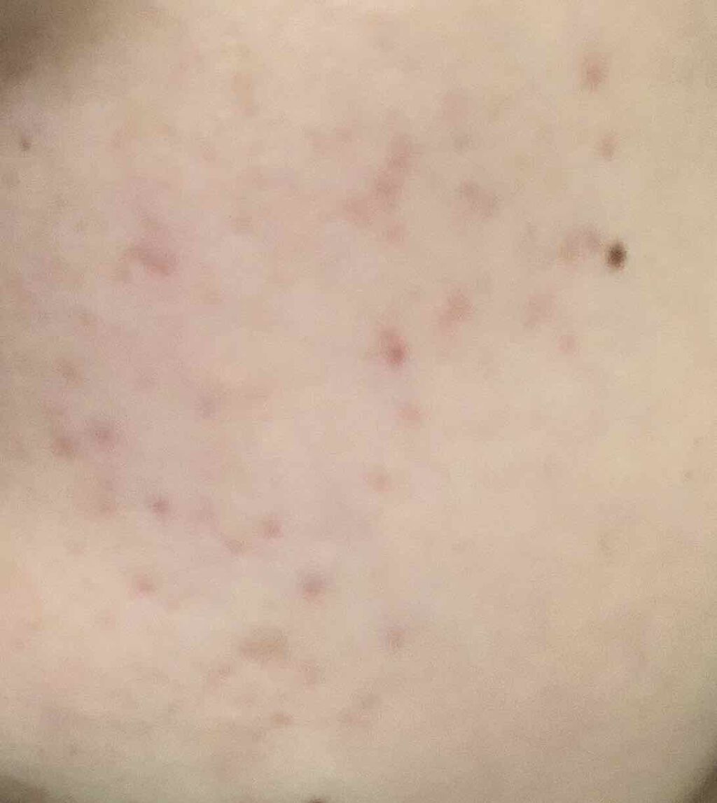 AHA·BHA·PHA 30デイズミラクルトナー/SOME BY MI/化粧水を使ったクチコミ（3枚目）