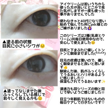 ピュア ナチュラル リンクル アイクリーム/pdc/アイケア・アイクリームを使ったクチコミ(4枚目)