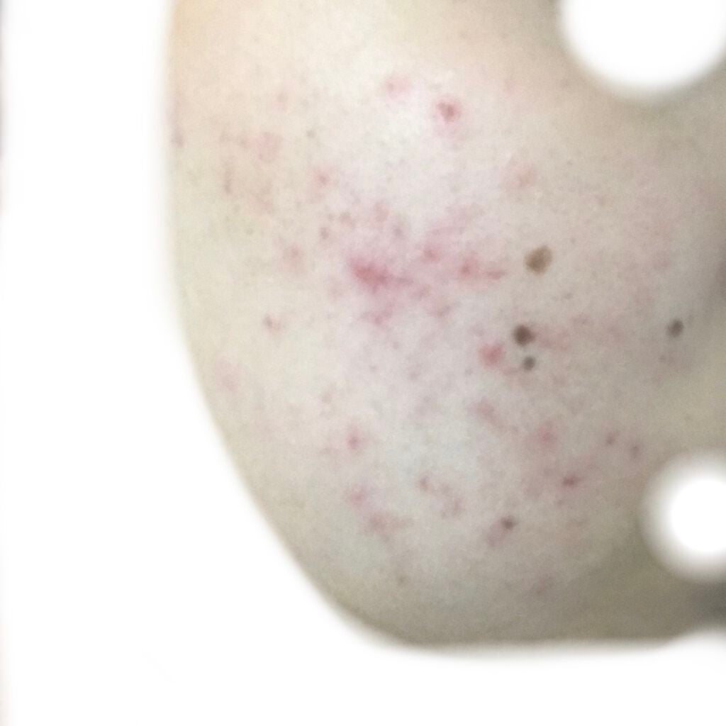 デュオ ザ クレンジングバーム クリア/DUO/クレンジングバームを使ったクチコミ(2枚目)