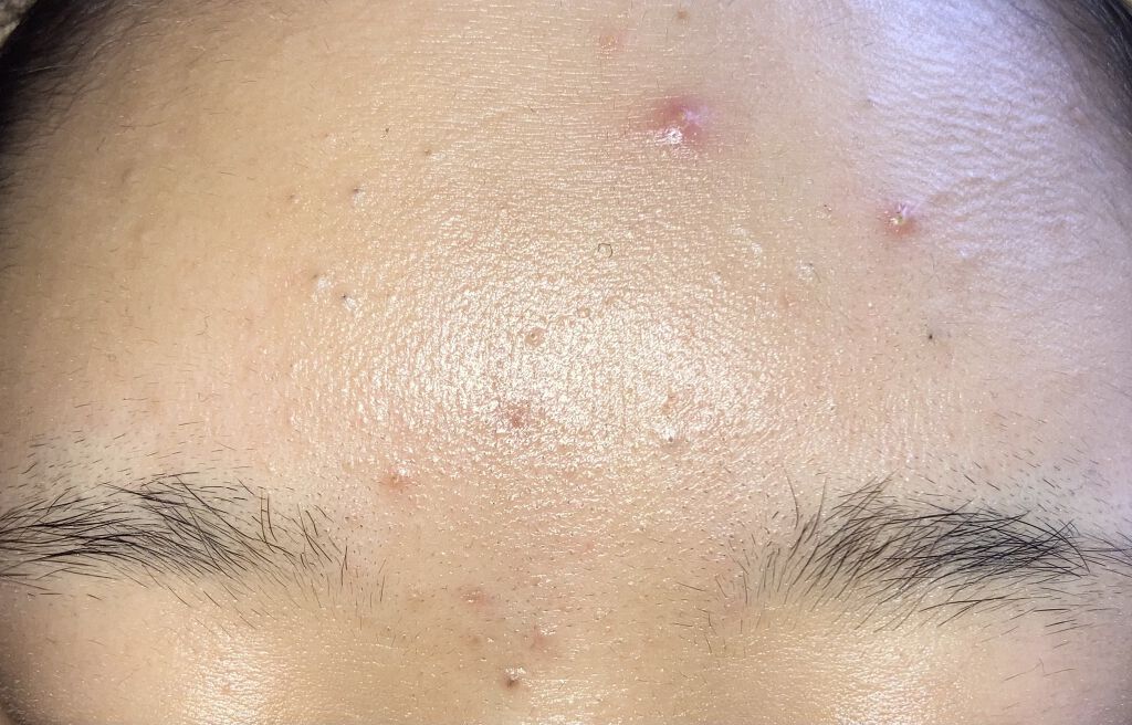 マイルド＆モイスチャーアロエジェル/ネイチャーリパブリック/ボディローションを使ったクチコミ（2枚目）