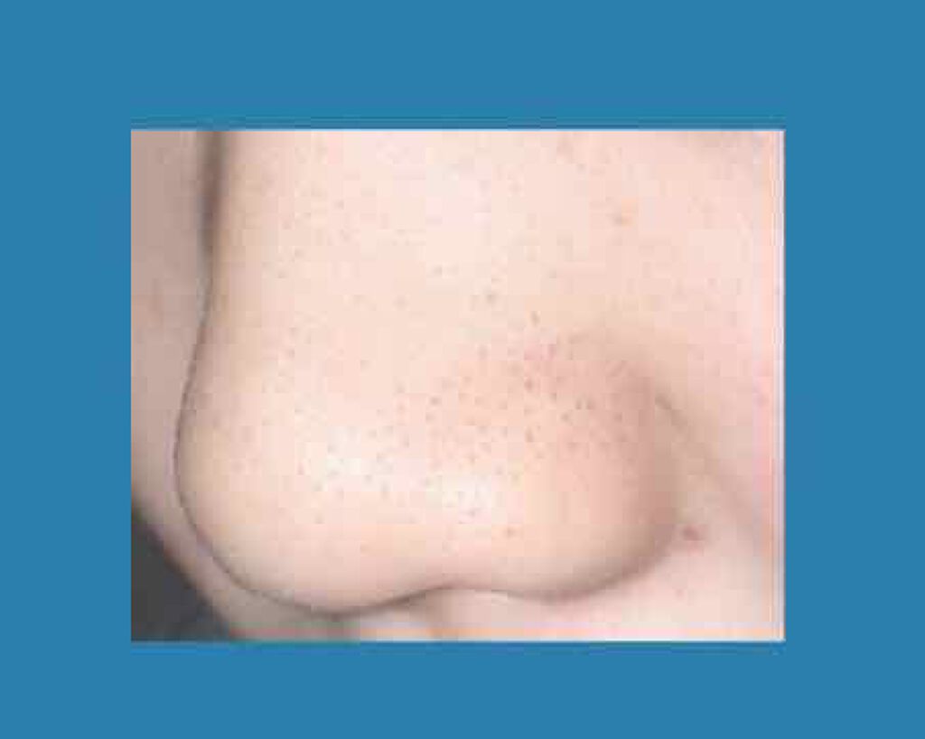 おうちdeエステ 肌をなめらかにする マッサージ洗顔ジェル/ビオレ/その他洗顔料を使ったクチコミ(3枚目)