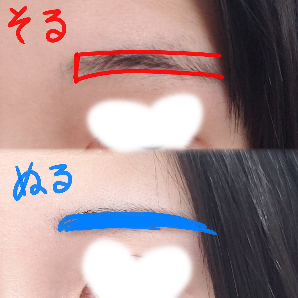 プレミア敏感肌用 Lディスポ/シック/シェーバーを使ったクチコミ（2枚目）