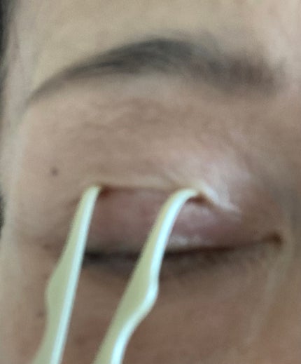 TWOOL ダブルアイリッドグルー/SHOBIDO/二重まぶた用アイテムを使ったクチコミ(7枚目)