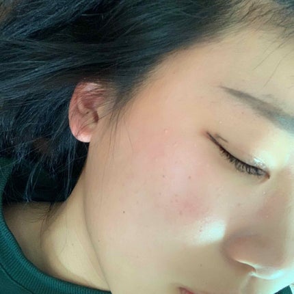 ハトムギ化粧水(ナチュリエ スキンコンディショナー R )/ナチュリエ/化粧水を使ったクチコミ(1枚目)