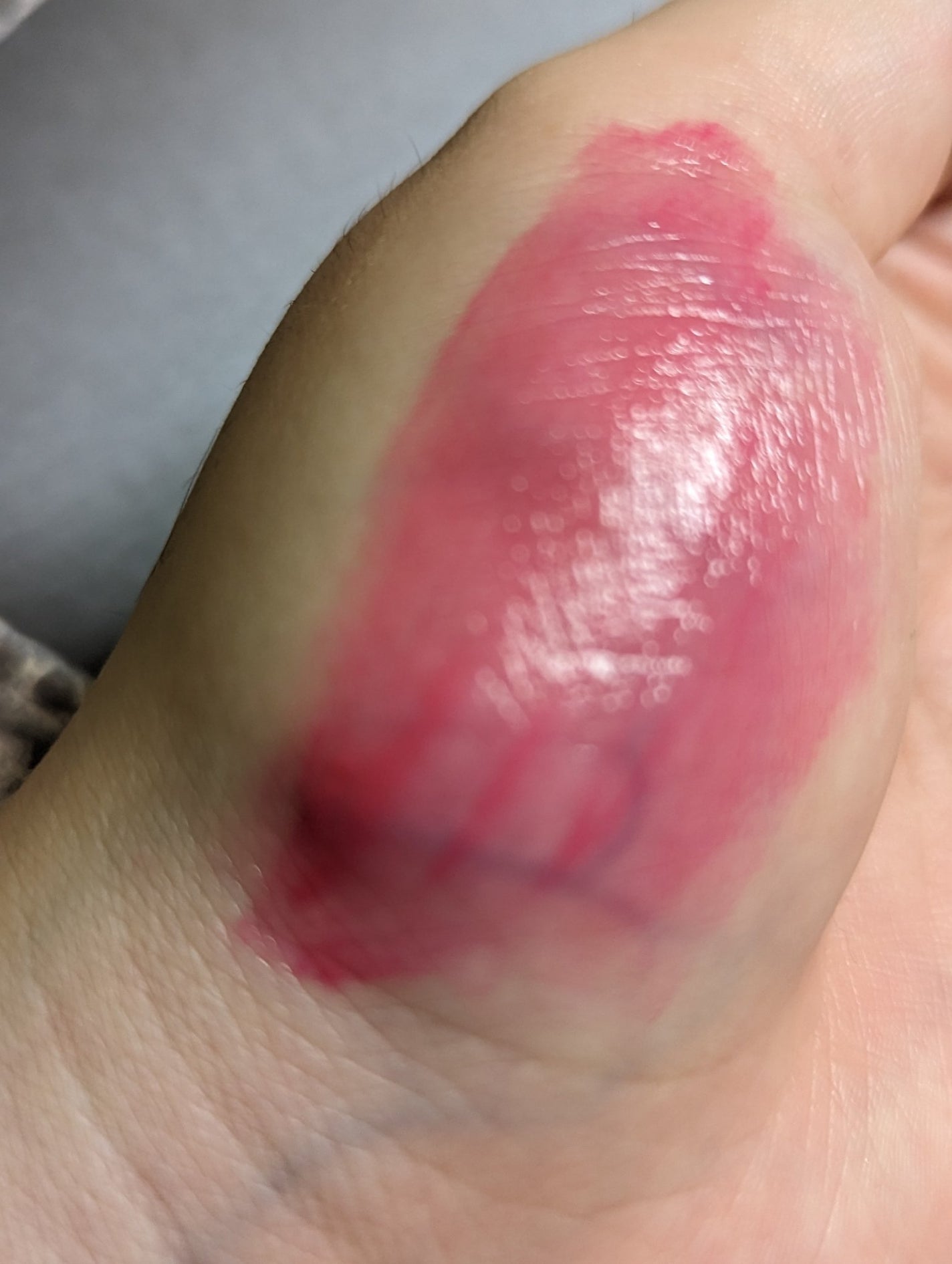 タンフルグラスティント/Colorgram/リップティントを使ったクチコミ(7枚目)