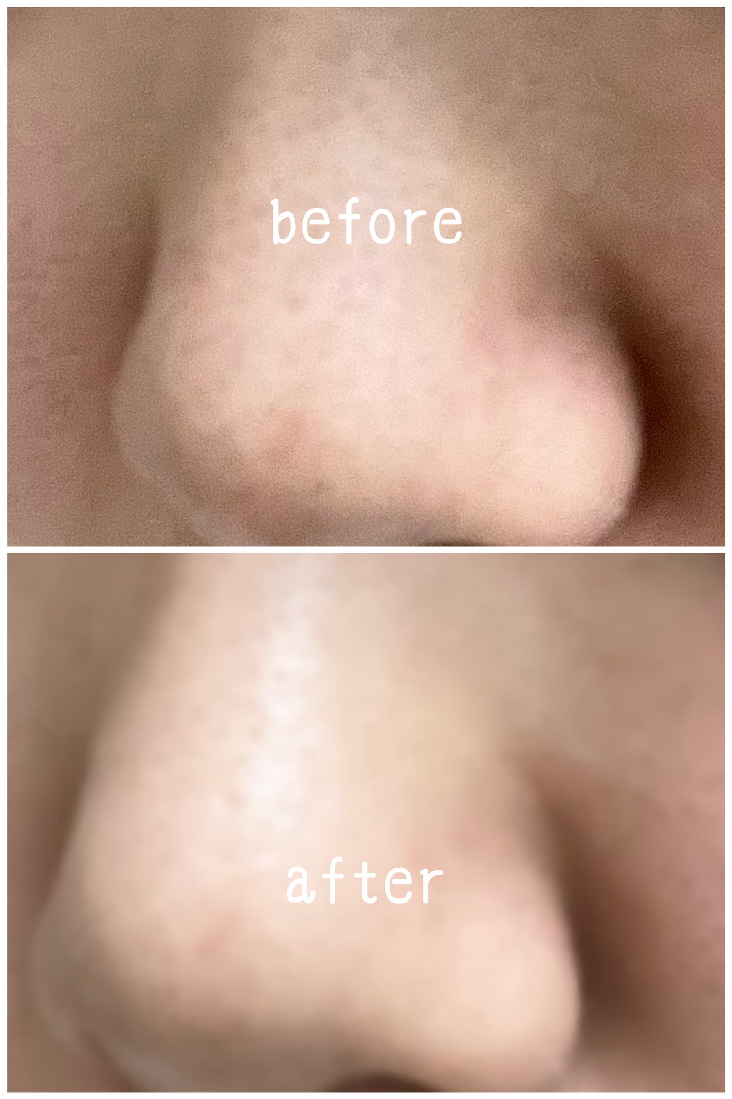 ソフィーナ iP ポア クリアリング ジェル ウォッシュ/SOFINA iP/その他洗顔料を使ったクチコミ(2枚目)