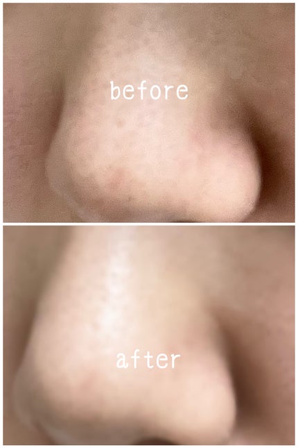 ソフィーナ iP ポア クリアリング ジェル ウォッシュ/SOFINA iP/その他洗顔料を使ったクチコミ(2枚目)