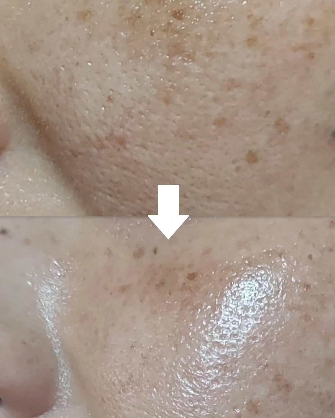 リードルショット100/VT/美容液を使ったクチコミ(2枚目)