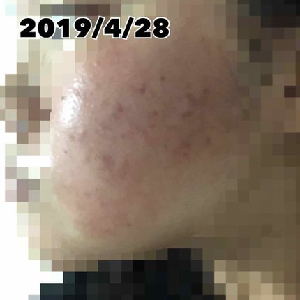 を使ったクチコミ(3枚目)