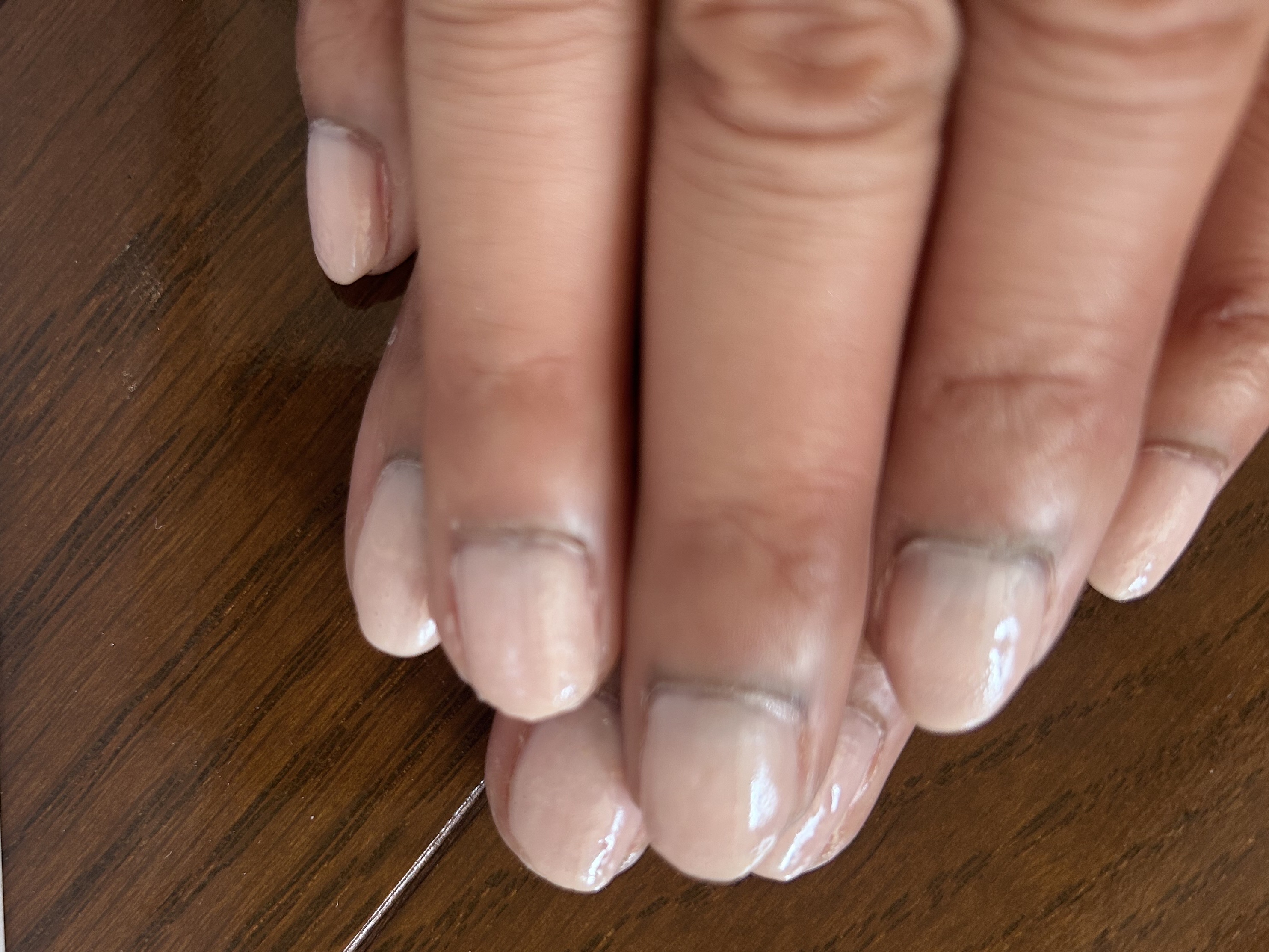 ネイルホリック つめ用ファンデ/ネイルホリック/ネイルトップコートを使ったクチコミ（2枚目）