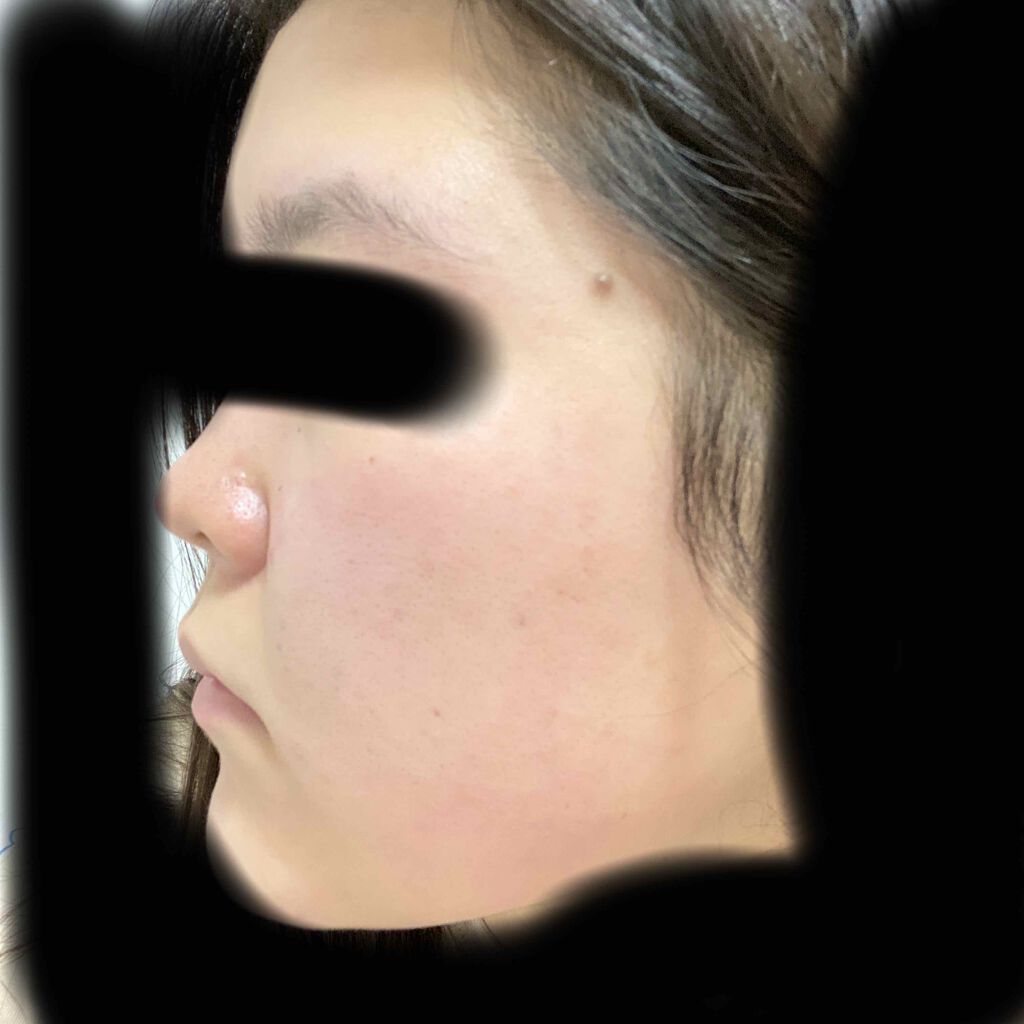 ハトムギ化粧水(ナチュリエ スキンコンディショナー R )/ナチュリエ/化粧水を使ったクチコミ(3枚目)