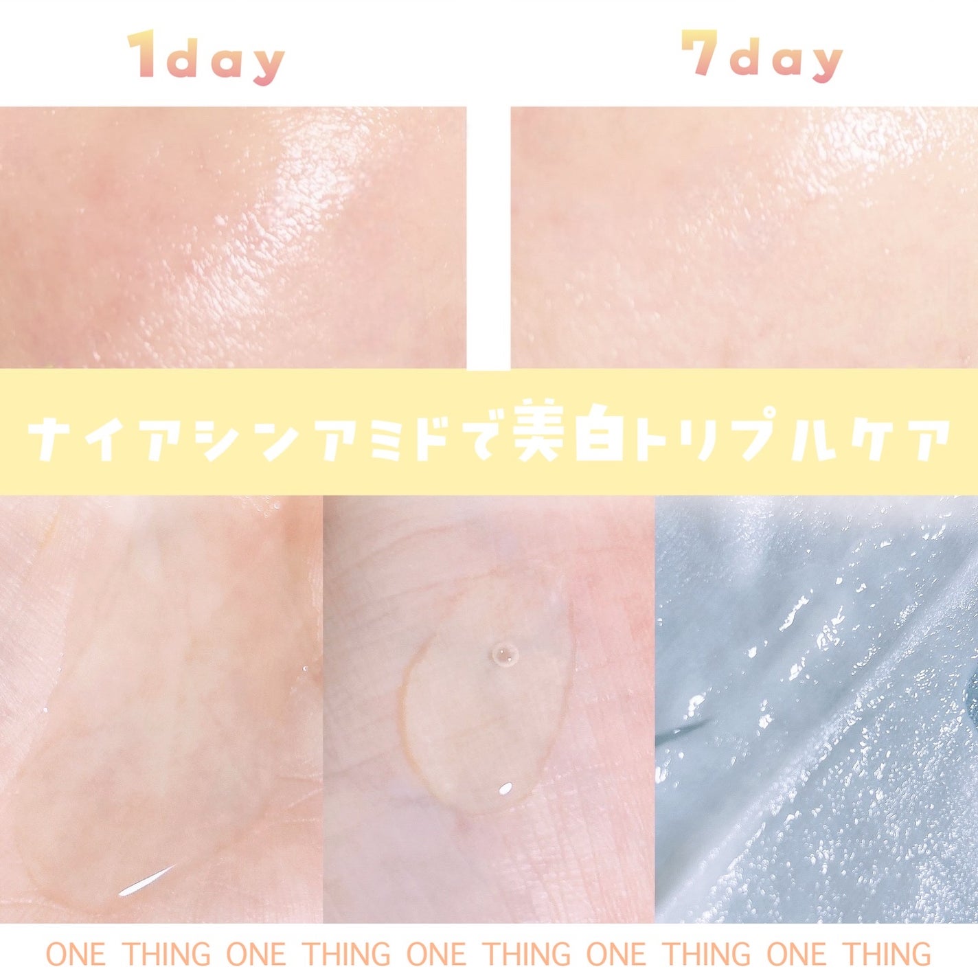 れいれいの美容垢🪞フォロバ100 on LIPS 「ナイアシンアミドで美白トリプルケア✨️シミ・ニキビ跡・くすみを..」(1枚目)