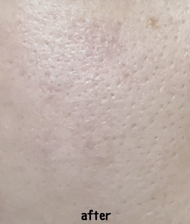 レチノール　シカ　リペア　セラム/innisfree/美容液を使ったクチコミ（3枚目）