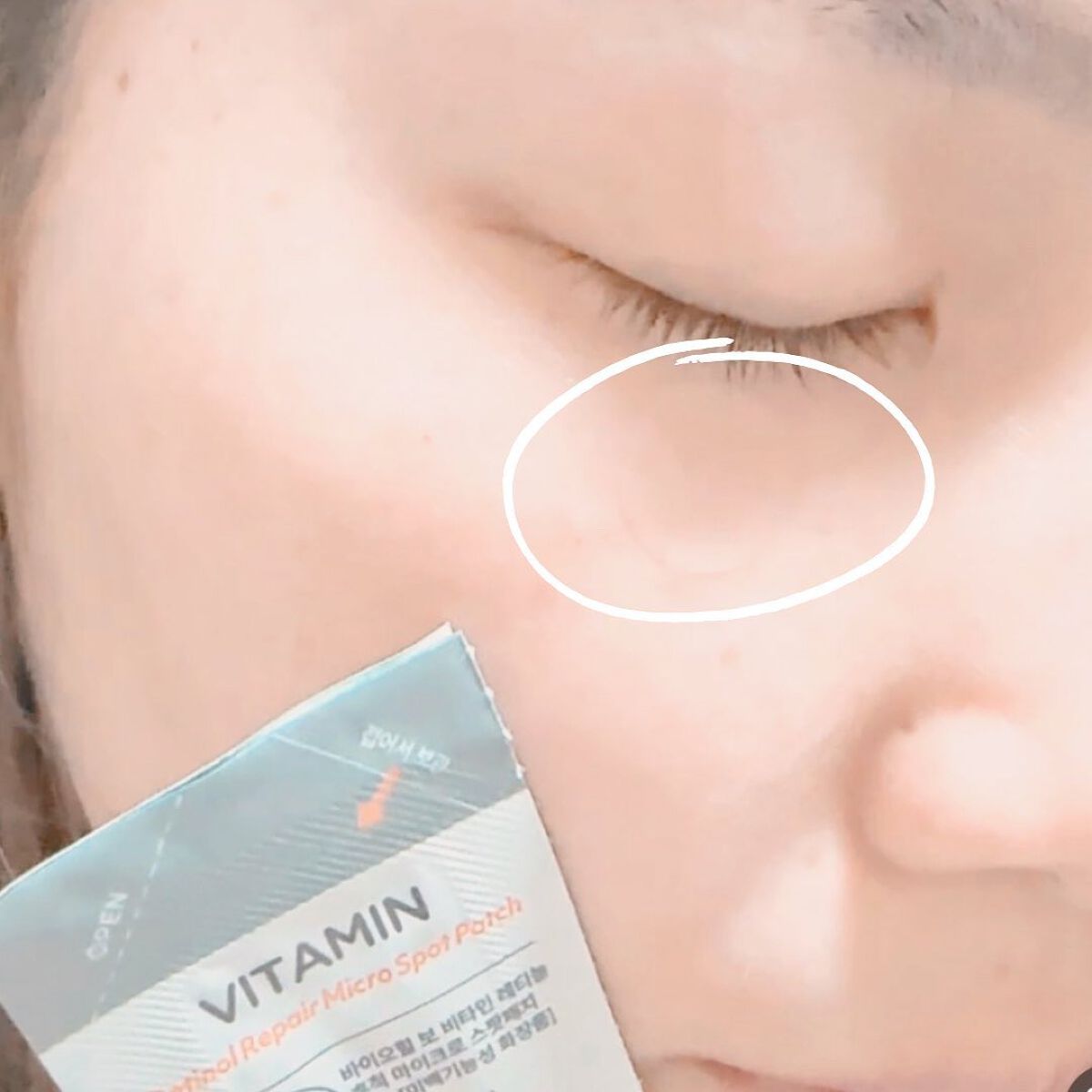 ビタミン レチノール リペア マイクロ スポット パッチ/BIOHEAL BOH/その他スキンケアを使ったクチコミ(7枚目)