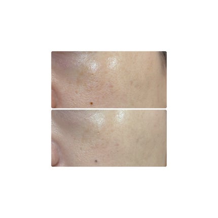 グロウフィットセラムカバークッション/ダルバ/クッションファンデーションを使ったクチコミ(7枚目)