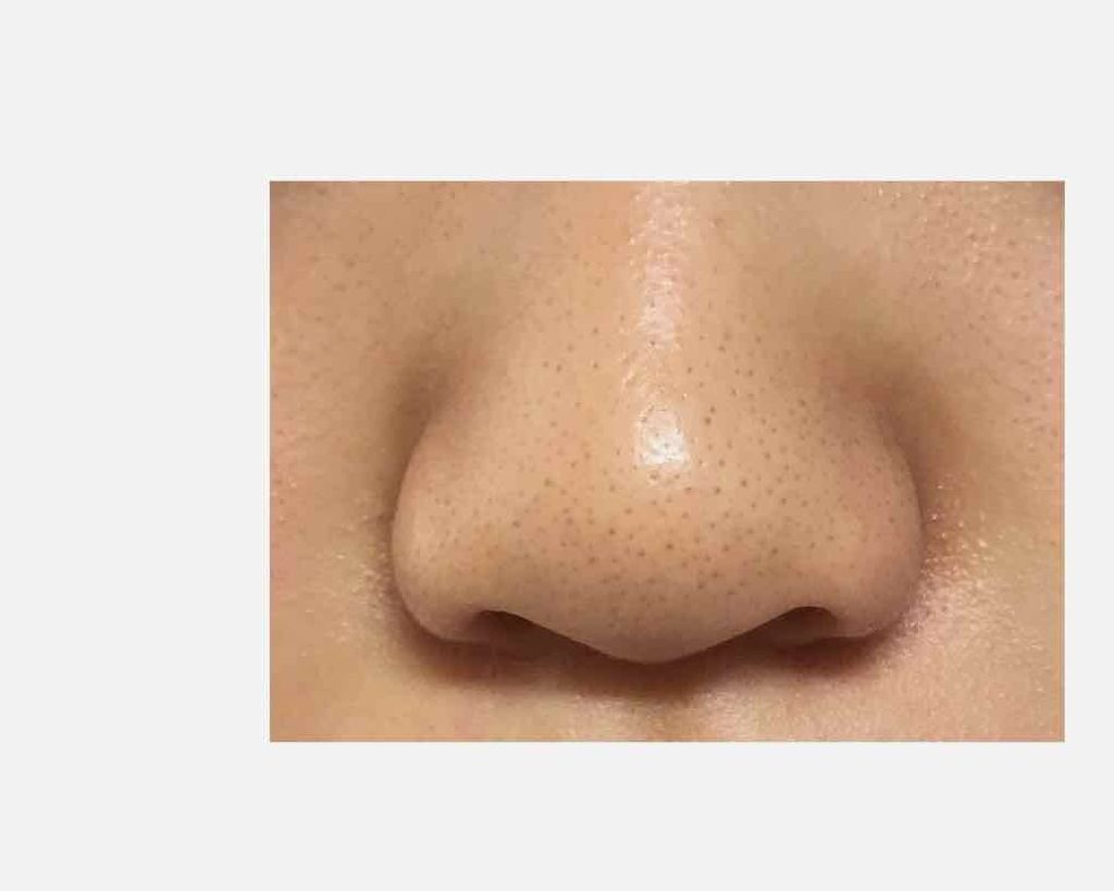 ハトムギ化粧水(ナチュリエ スキンコンディショナー R )/ナチュリエ/化粧水を使ったクチコミ(2枚目)