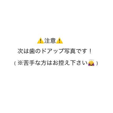 デンタルホワイトニング/プロポリンス/マウスウォッシュ・スプレーを使ったクチコミ(2枚目)