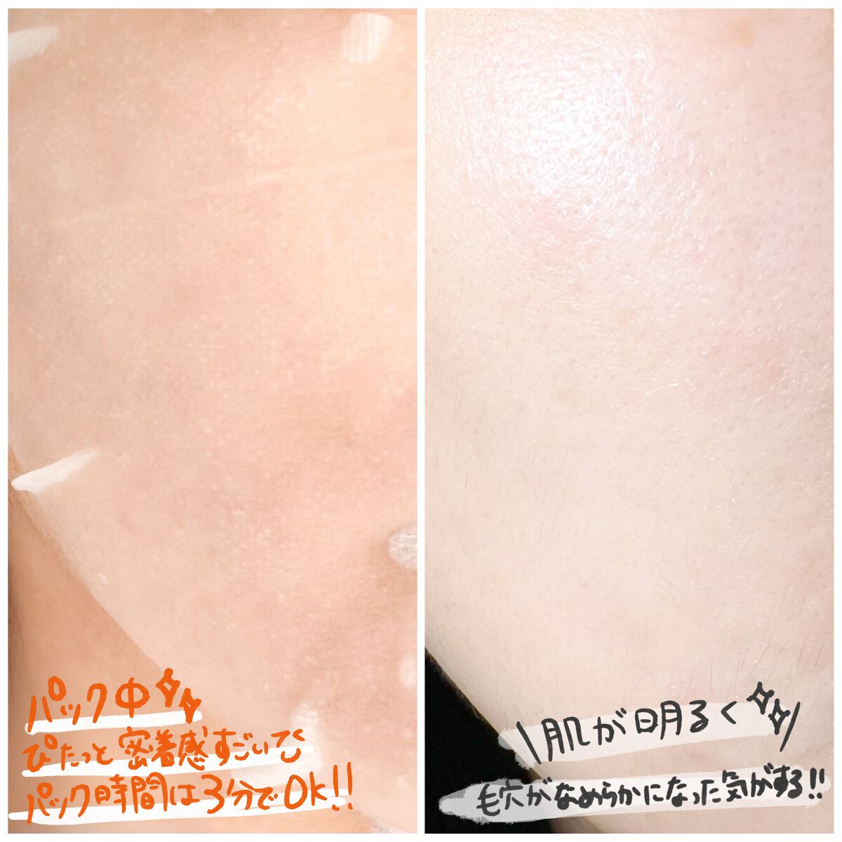 ダーマレーザースーパーVC100マスク/クオリティファースト/シートマスク・パックを使ったクチコミ(4枚目)