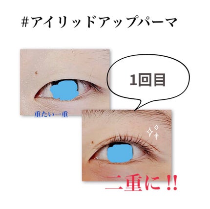 ひとえ・奥ぶたえ用カーラー/アイプチ®/ビューラーを使ったクチコミ(1枚目)