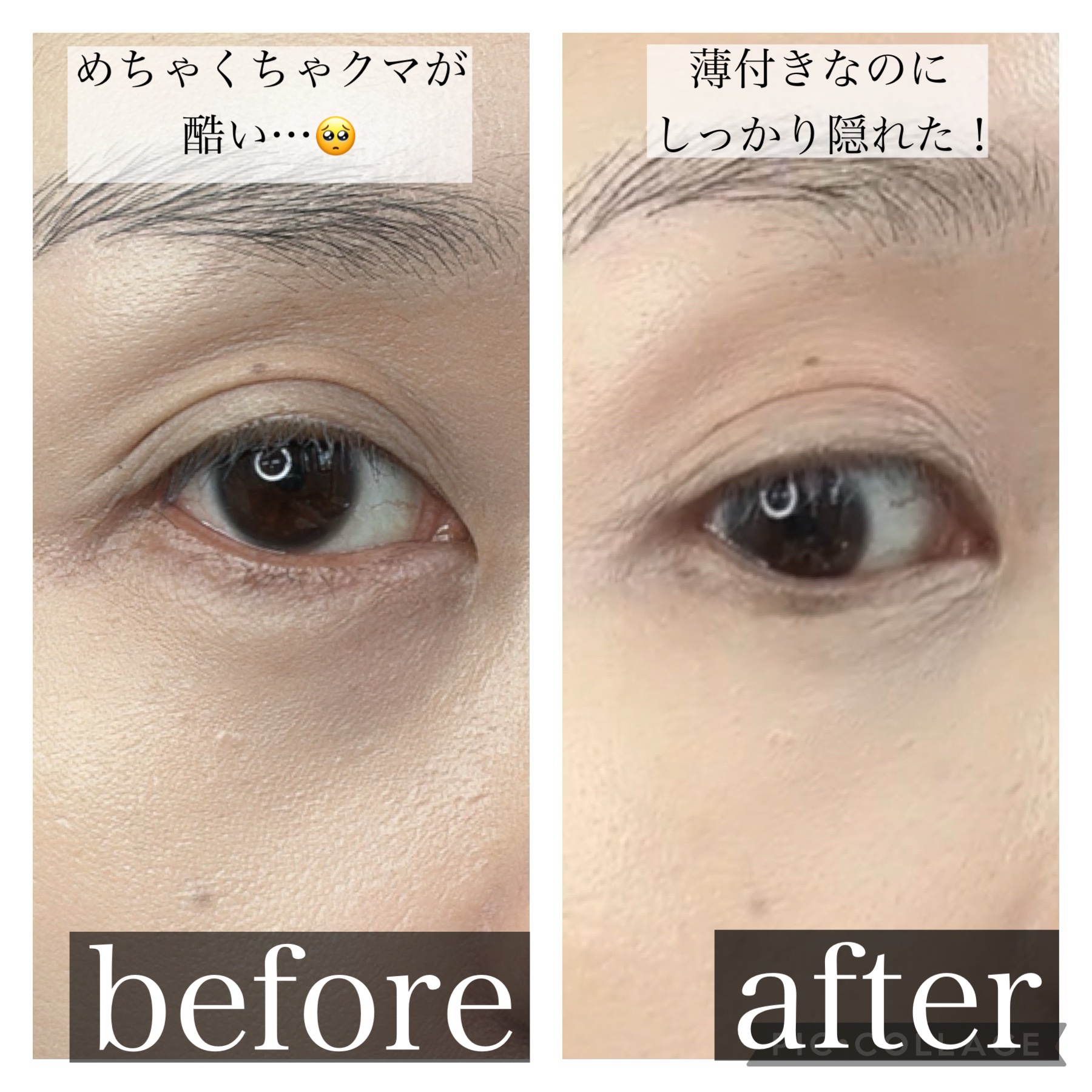 エクストラ スキニー コンシーラー 01 ライトベージュ/Visée/リキッドコンシーラーを使ったクチコミ（2枚目）