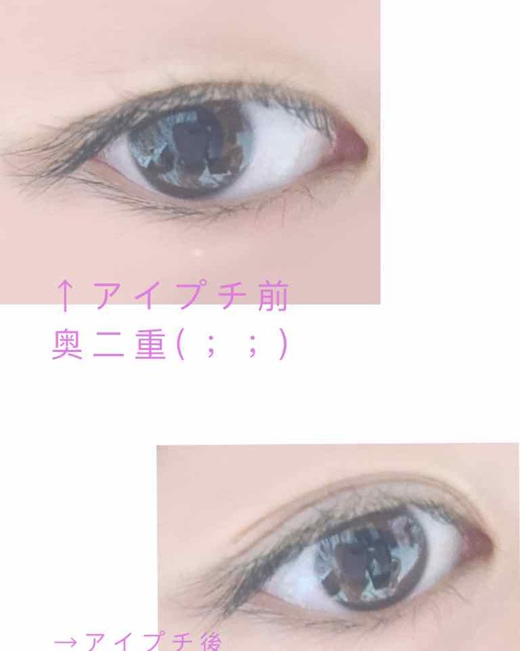 資生堂ベビーパウダー(プレスド)/ベビー/ボディパウダーを使ったクチコミ(2枚目)