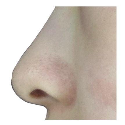 ノーモアブラックヘッド(ノーズピーリング)/One-day's you/スクラブ・ゴマージュを使ったクチコミ(6枚目)