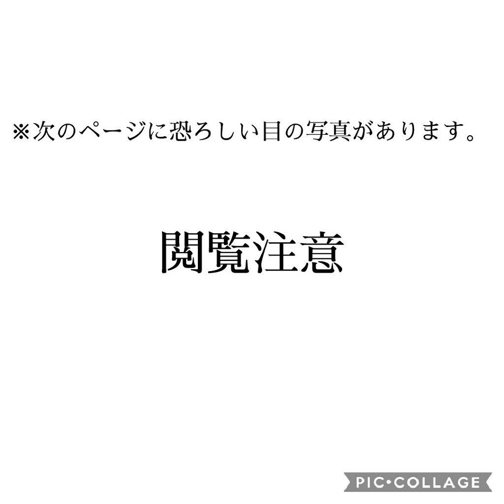 シングルアイテープ/Automatic Beauty/二重まぶた用アイテムを使ったクチコミ(2枚目)