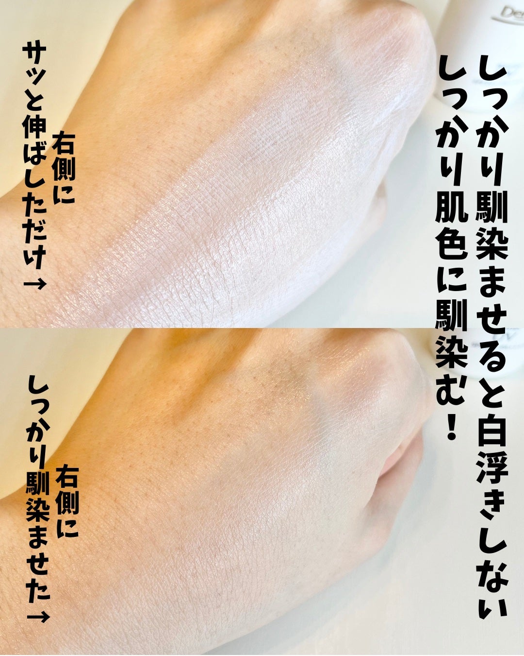モイストミルク/ダーマセプトRX/乳液を使ったクチコミ(6枚目)