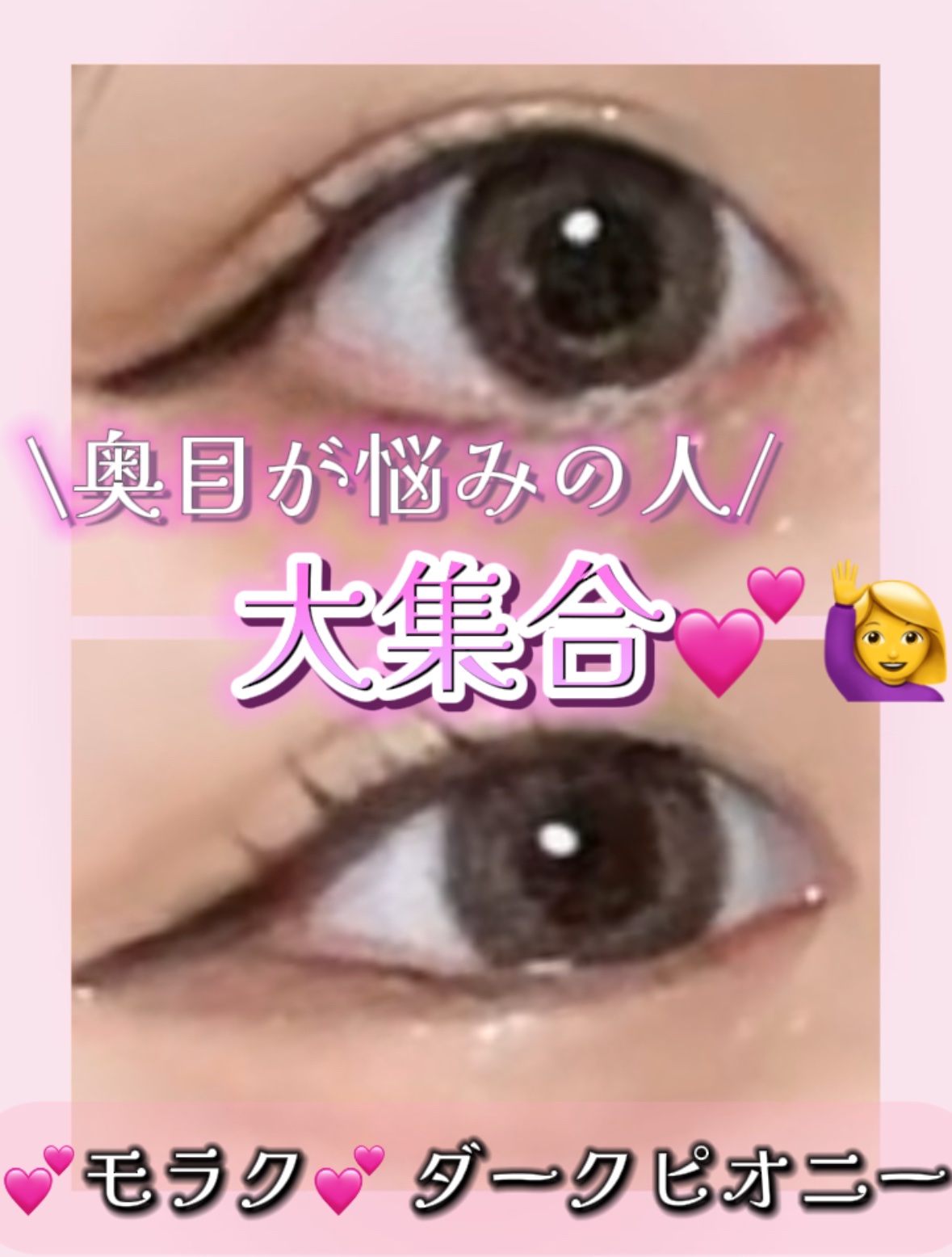 奥目民🙋‍♀️大集合！！！目に光を与えてくれるこの激カワカラコン💗💓モラクのダークピオニー🥜
(∩´∀`∩)💕

ほんとーに盛れまくりなので是非使ってみてください✨😊
#molak #モラクワンデー #カラコン  #私の上半期ベ