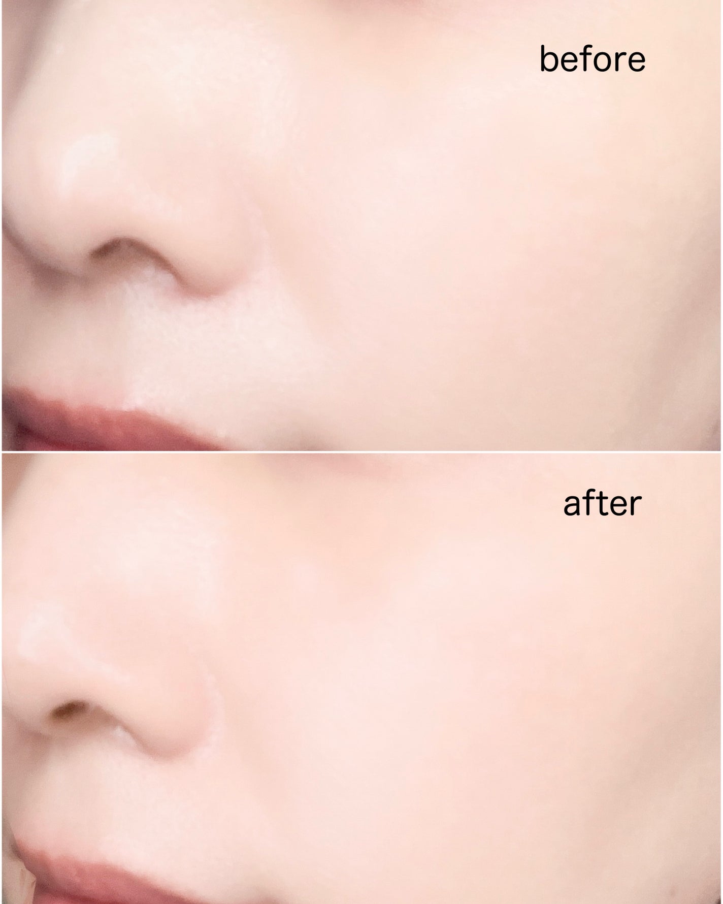 ダイブイン セラム/Torriden/美容液を使ったクチコミ(5枚目)