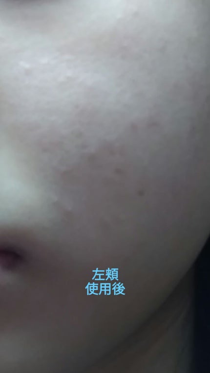 ティーツリーケアソリューション アンプルマスクJEX/MEDIHEAL/シートマスク・パックを使ったクチコミ(4枚目)