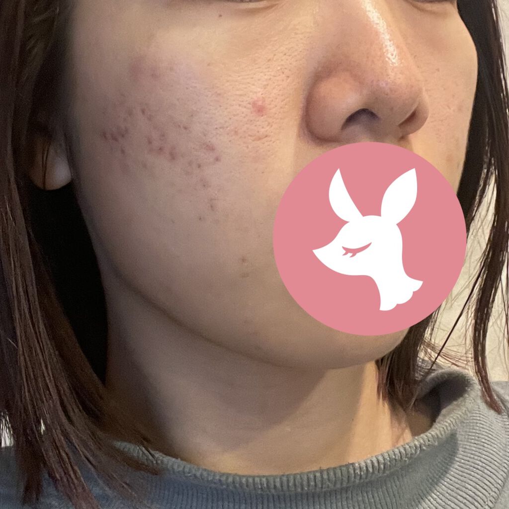 クリーム UFC/Kiehl's/フェイスクリームを使ったクチコミ（3枚目）