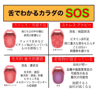 ミリミリ|美容アカウント on LIPS 「『舌でわかるカラダの状態』それSOSサインかも！？◯ふちがボコ..」（3枚目）