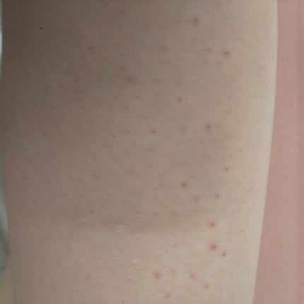 ボタニカルズ 除毛クリーム 敏感肌用/Veet/除毛クリームを使ったクチコミ(2枚目)