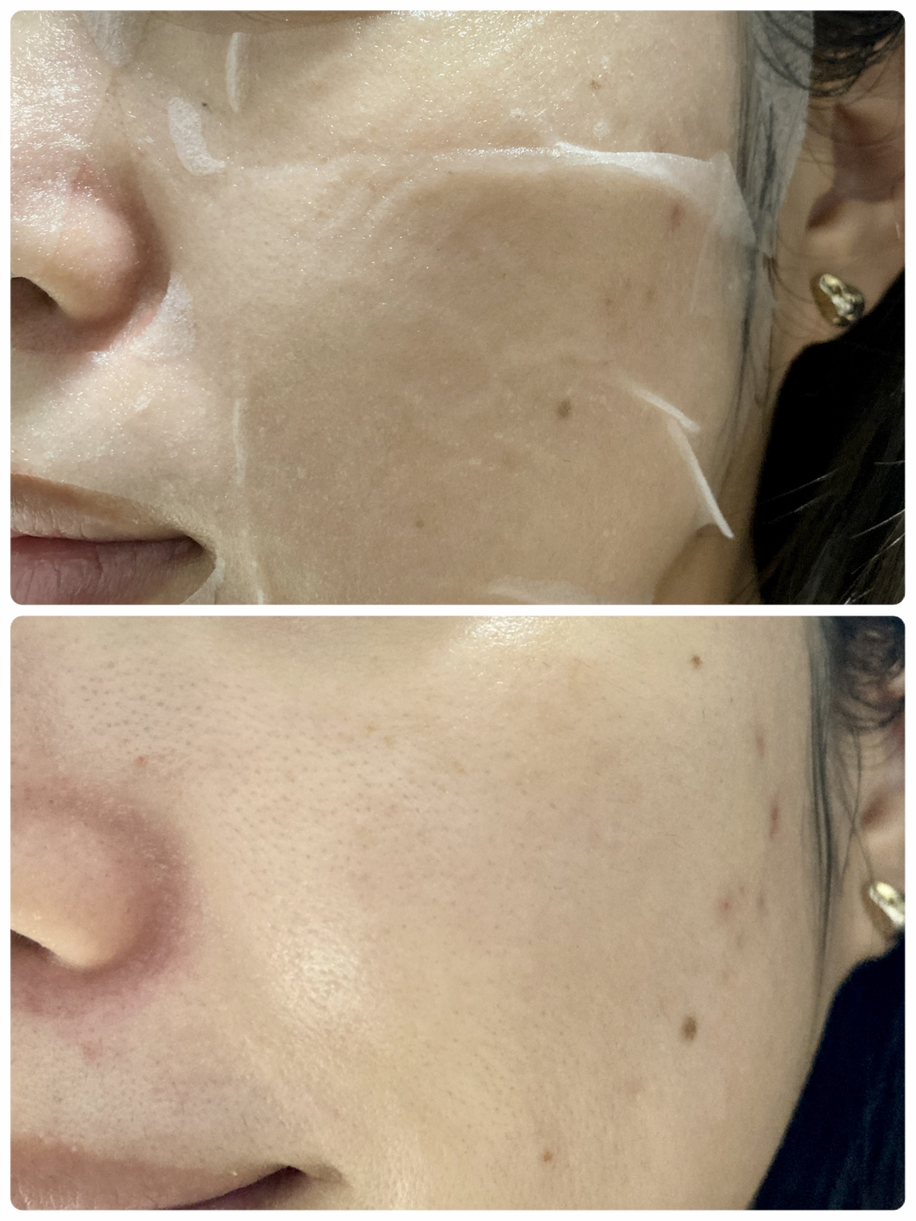 メイクルーティンマスクR/b idol/シートマスク・パックを使ったクチコミ（3枚目）