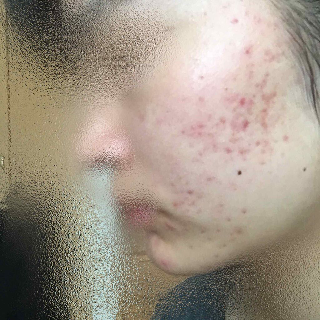 ホワイトアップ ローション(III)/アクアレーベル/化粧水を使ったクチコミ（2枚目）