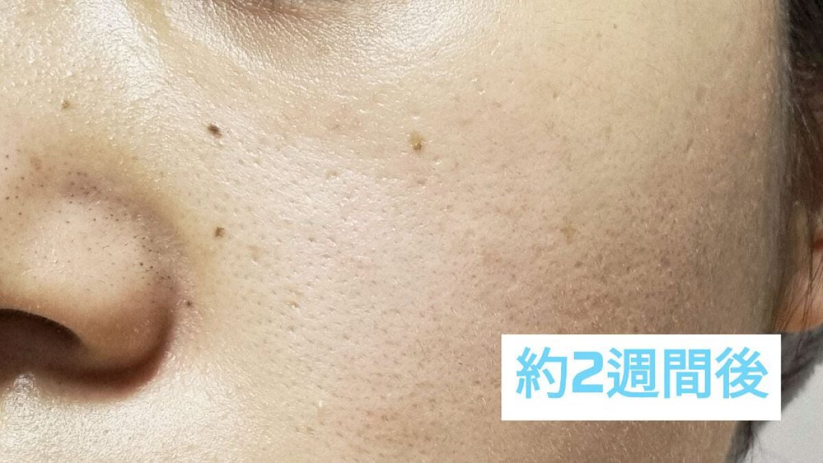 ザビタミンC23/IOPE/美容液を使ったクチコミ(5枚目)