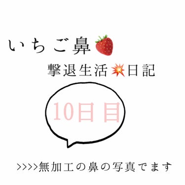 いちご鼻撃退日記10日目！

鼻から毛が生えてるのは、恐らく毛穴なので
コロナが治まったら脱毛に行きたいと思ってます！

黒ずみは無くなったてきたけど、
白い角栓？みたいなのが詰まってる気がする…

こ