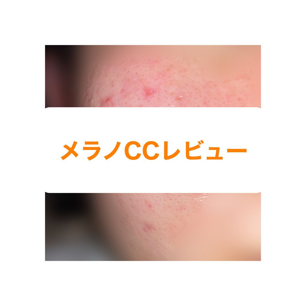 薬用 しみ 集中対策 美容液/メラノCC/美容液を使ったクチコミ(1枚目)