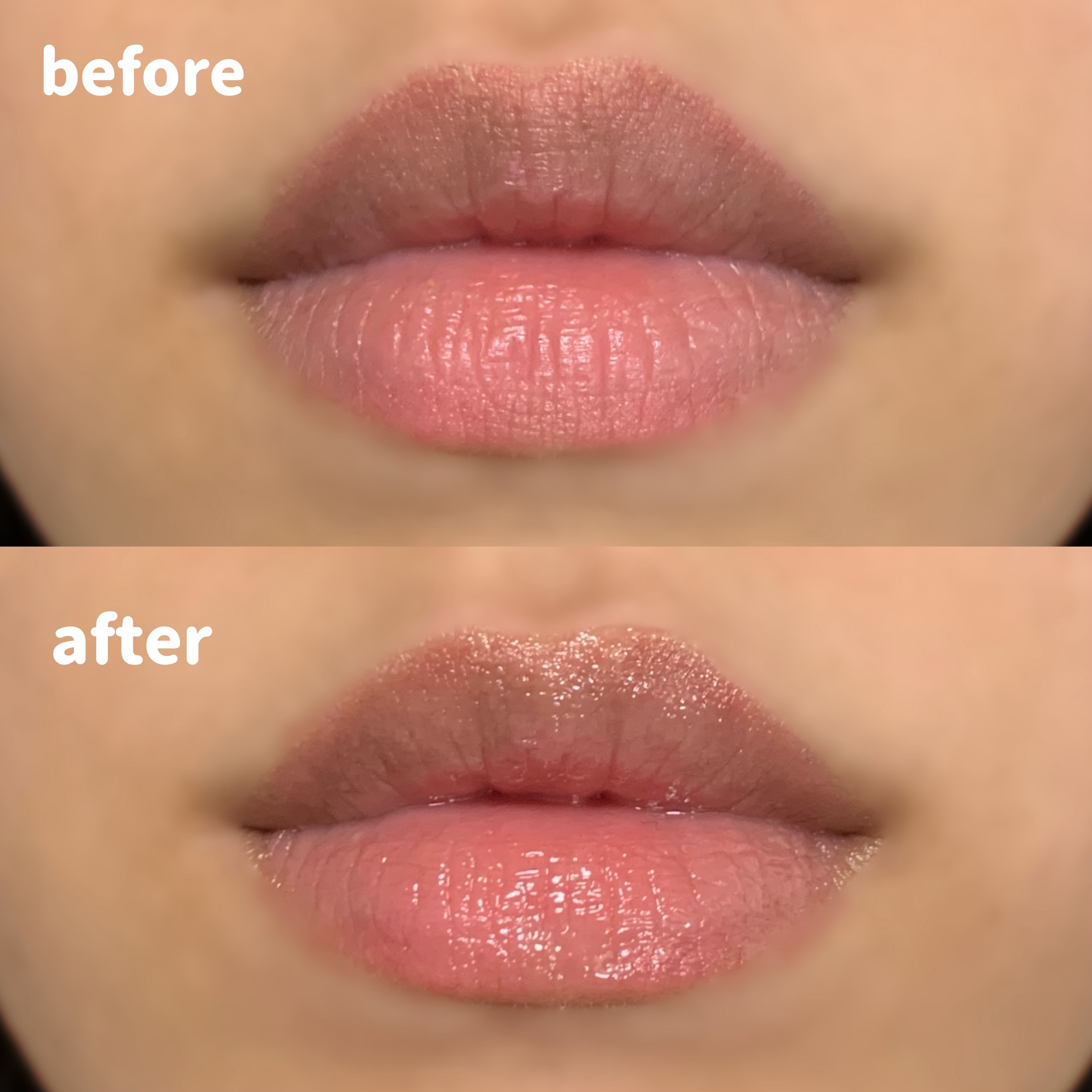 ちゅるリップランパー/muice/リッププランパーを使ったクチコミ（3枚目）