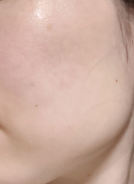 ミルキィジェル AD/ACSEINE/乳液を使ったクチコミ(3枚目)