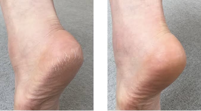 ピジョン リペアニプルのクチコミ「(* ⁰̷̴͈ᗜ⁰̷̴͈)‧˚₊*̥  ｛あけましておめでとう
               .....」（2枚目）