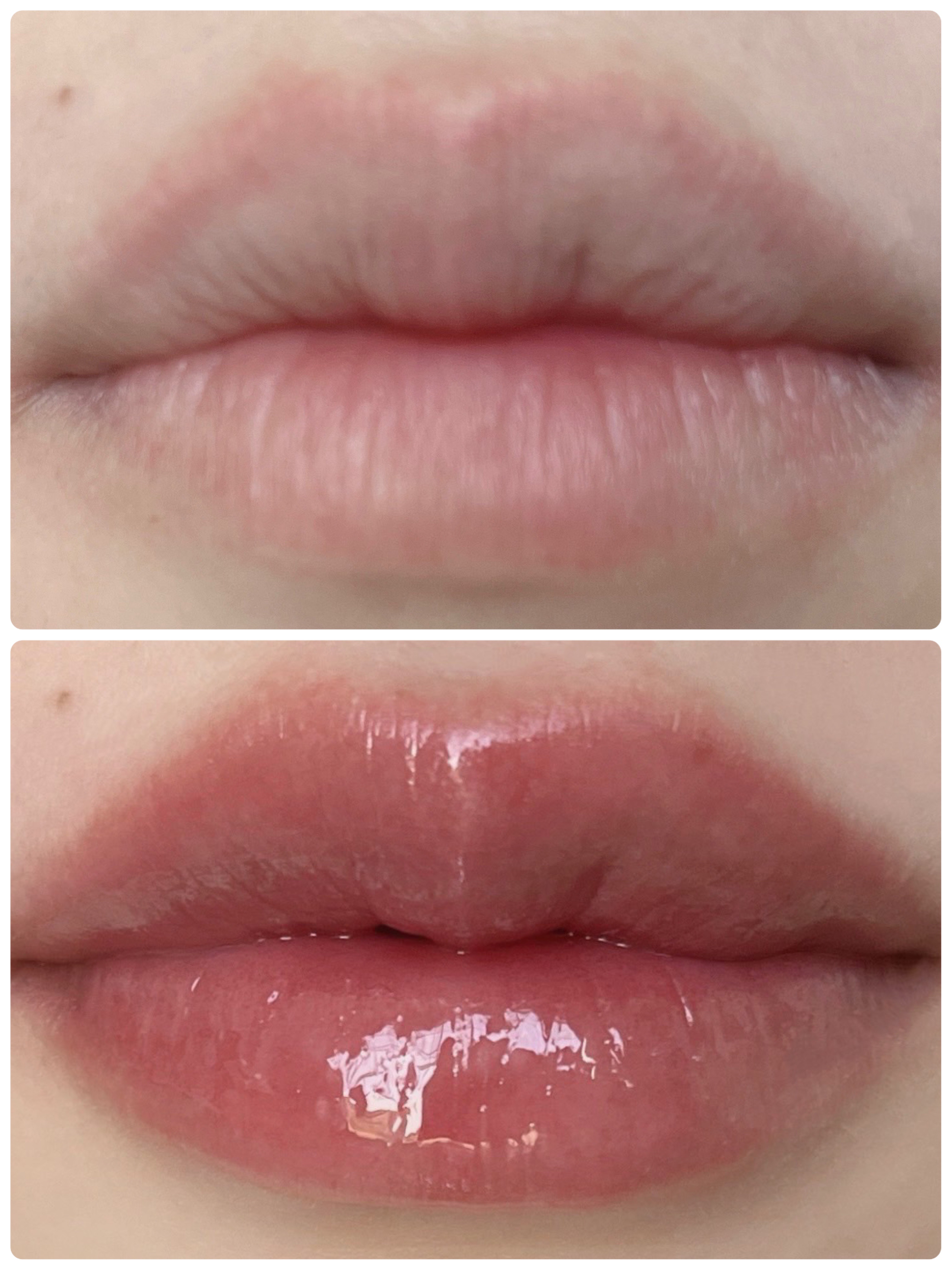 オールマイシングス トゥルービューティ キス リッププランパー/all my things/リッププランパーを使ったクチコミ（2枚目）