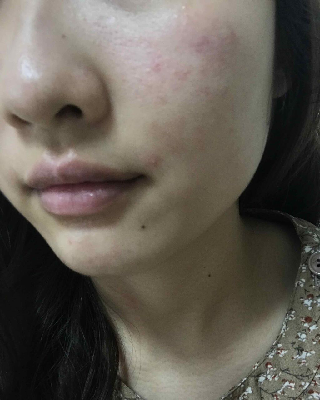 白潤プレミアム 薬用浸透美白乳液/肌ラボ/乳液を使ったクチコミ（2枚目）