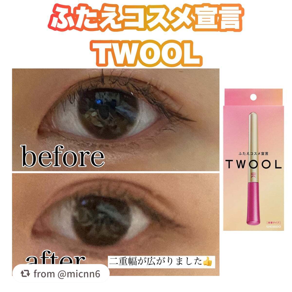 TWOOL ダブルアイリッドグルー/SHOBIDO/二重まぶた用アイテムを使ったクチコミ(1枚目)