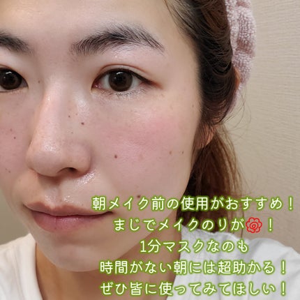 レッドブレミッシュクイックPHAシートマスク/Dr.G/シートマスク・パックを使ったクチコミ(6枚目)