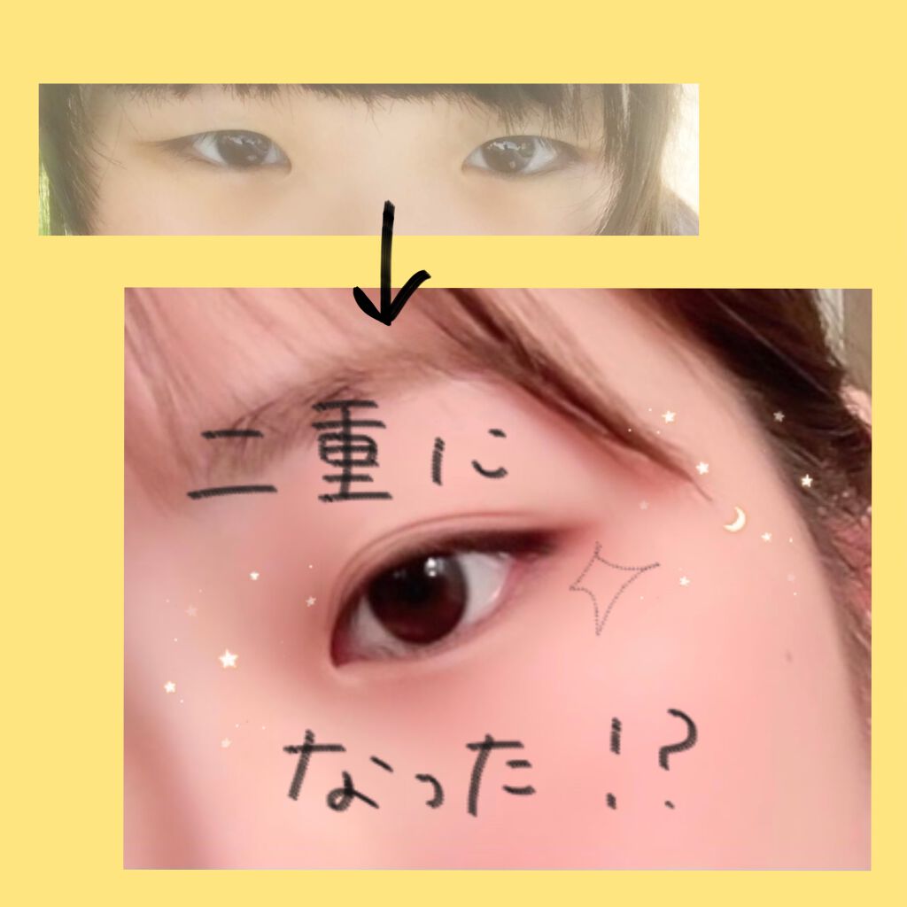 アイビューティー フィクサー WP/アストレア ヴィルゴ/二重まぶた用アイテムを使ったクチコミ(1枚目)