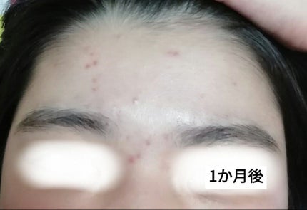 ロゼット洗顔パスタ アクネクリア/ロゼット/洗顔フォームを使ったクチコミ(3枚目)